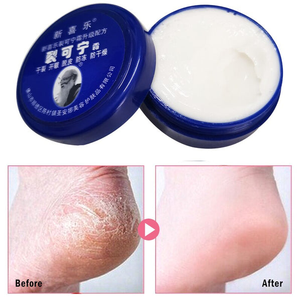 Chinese Foot Cream Herbs Crack Foot Cream Anti-Drying Heel Cracked Repair Cream Removal Dead Skin Hand Foot Care 33g