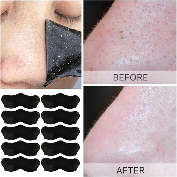 Unisex Blackhead Remove Mask Peel Nasal Strips Deep Cleansing Shrink